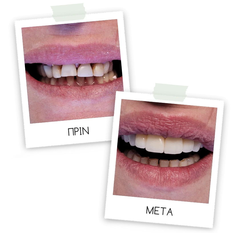 Οψεις δοντιων