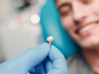 Υπηρεσία - Οδοντικά Εμφυτύματα