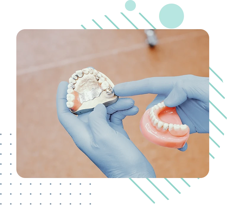 Προσθετική Οδοντιατρική