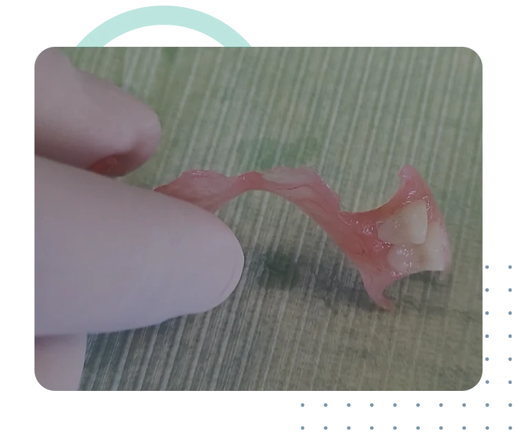 Μερικη/Ολικη οδοντοστοιχια